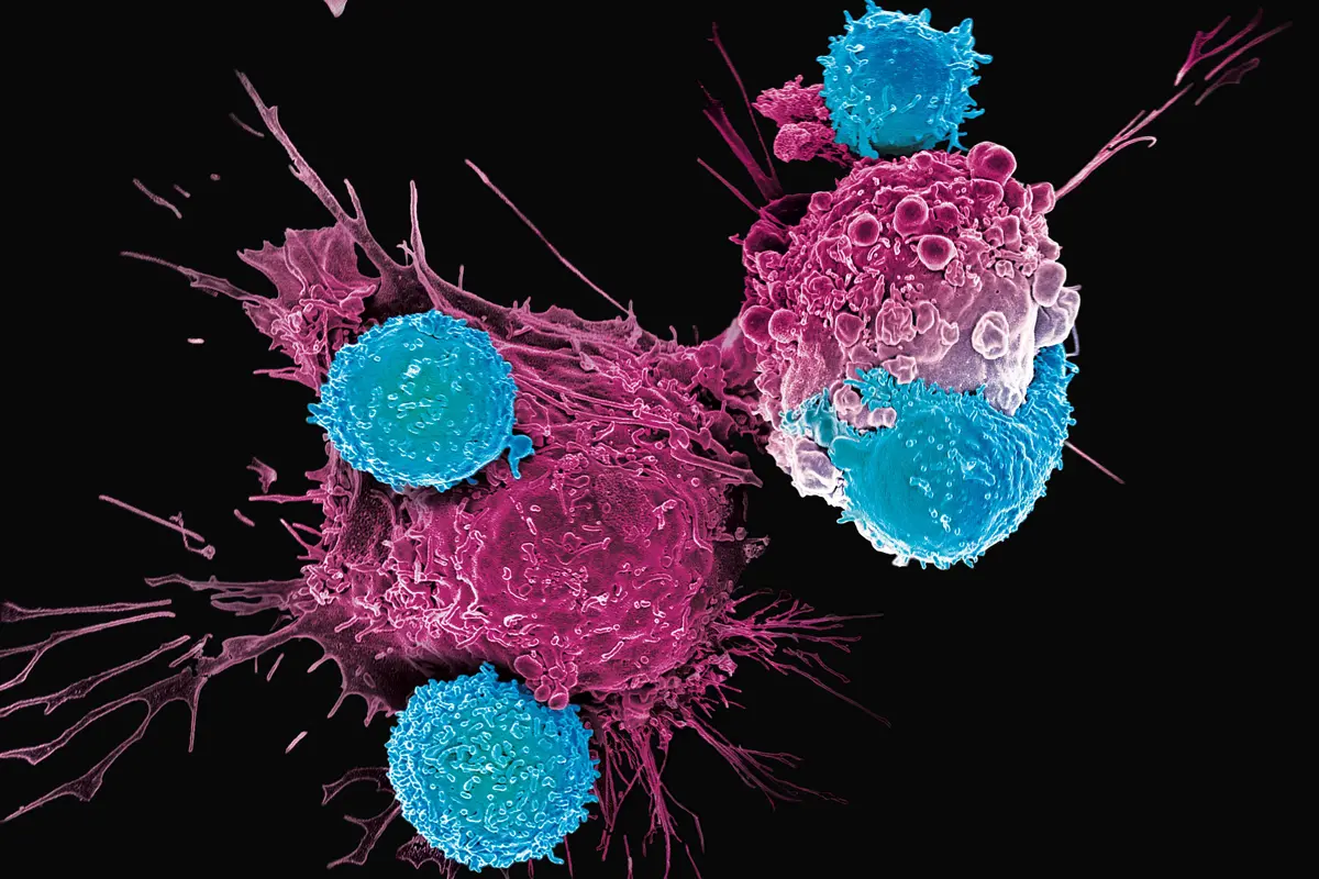 Terapia CAR-T Cell