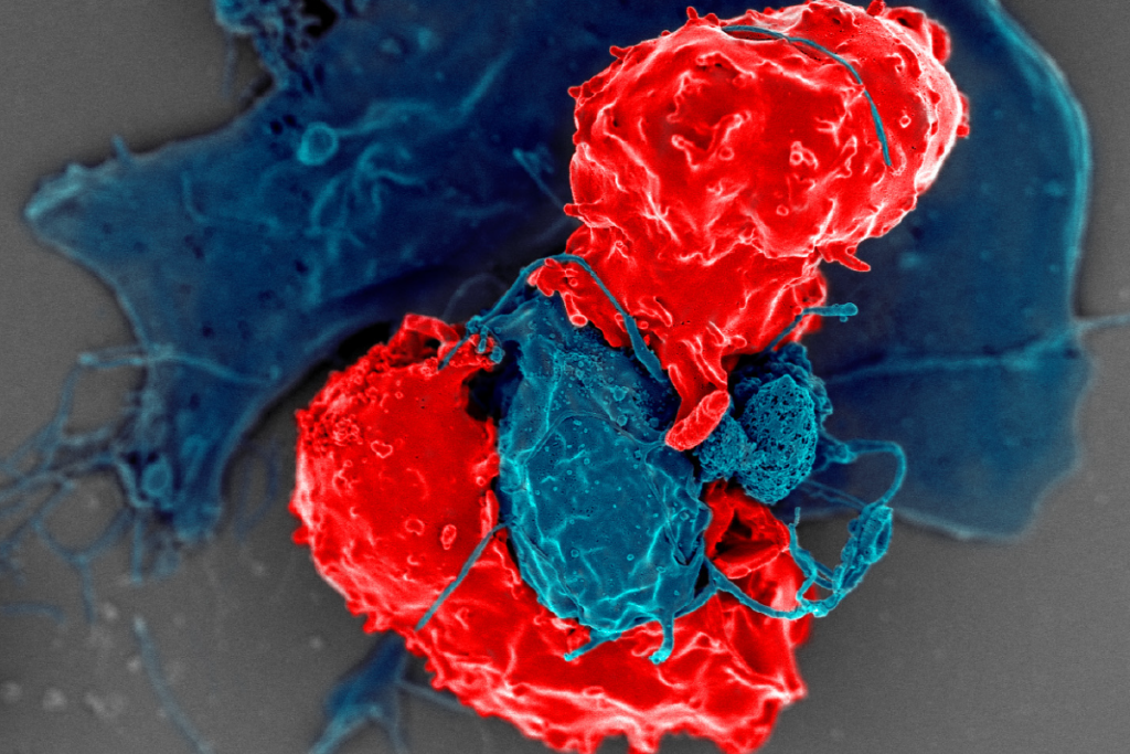 Descubra a evolução das gerações CAR-T e como elas estão revolucionando os tratamentos contra o câncer. Conheça os avanços e o futuro da imunoterapia.