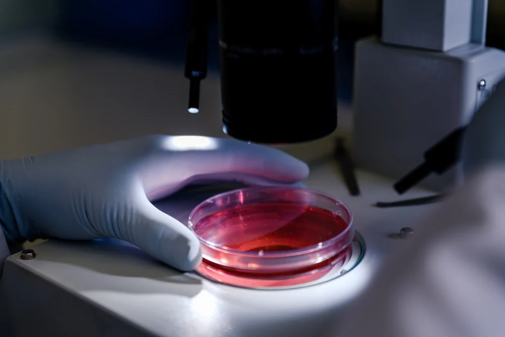 Pela 1ª vez, terapia CAR-T cell levou à remissão uma paciente com três doenças autoimunes graves. Entenda o caso e o impacto para a medicina.