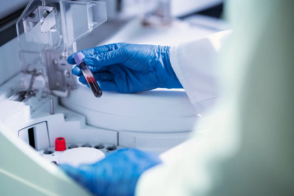 Novo ensaio clínico de CAR-T cell nos EUA e Reino Unido testa imunoterapia em tumores sólidos pediátricos. Saiba como funciona o estudo NexTGen.