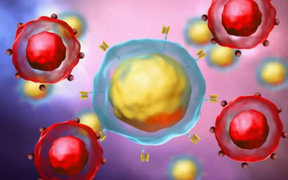 CAR-T cell em linfomas não Hodgkin de células B: resultados clínicos, aprovações pela Anvisa e perspectivas de acesso no Brasil.