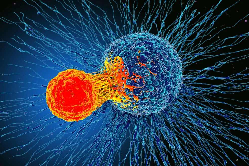 São Camilo realiza primeiro CAR-T cell para linfoma não Hodgkin. Entenda o procedimento e o que esse marco representa para a oncologia brasileira.