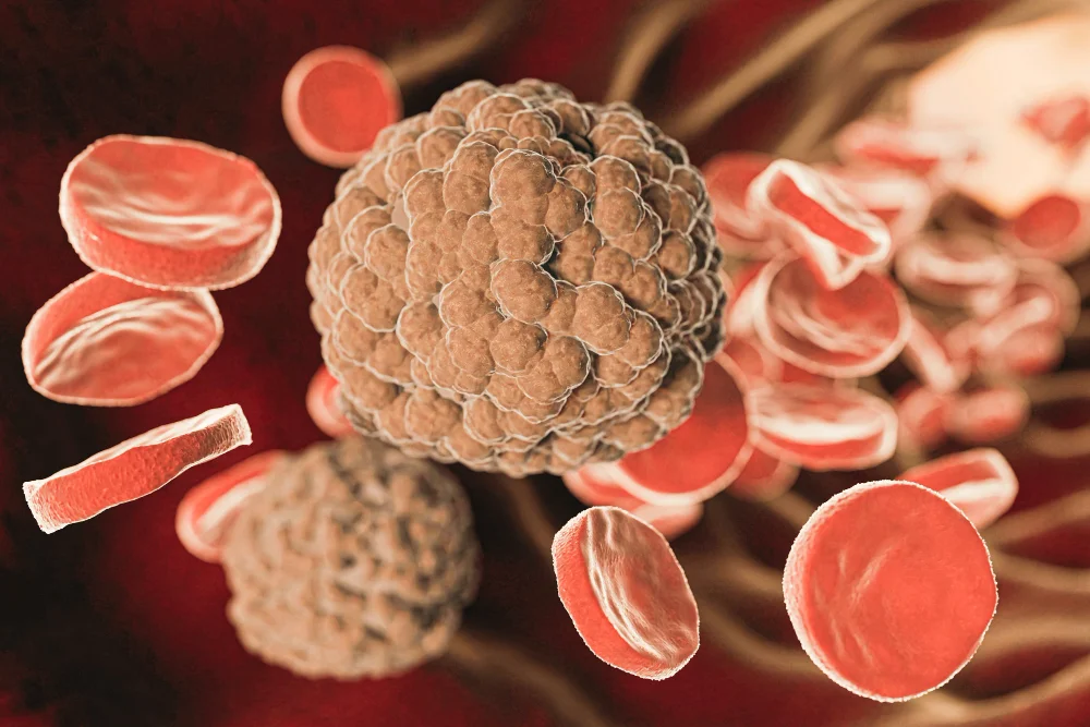 EULAR 2026 apresenta avanços da terapia CAR-T em artrite reumatoide, lúpus e esclerose sistêmica refratárias.