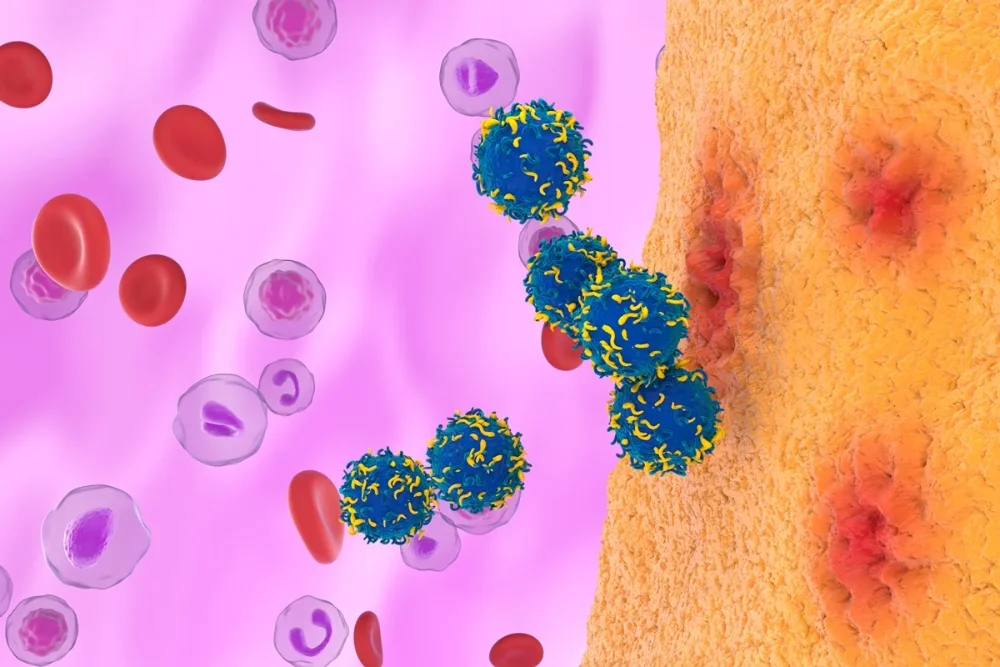 CAR-T será testada contra lúpus e miastenia gravis no Brasil. Entenda como funcionam os novos estudos clínicos.